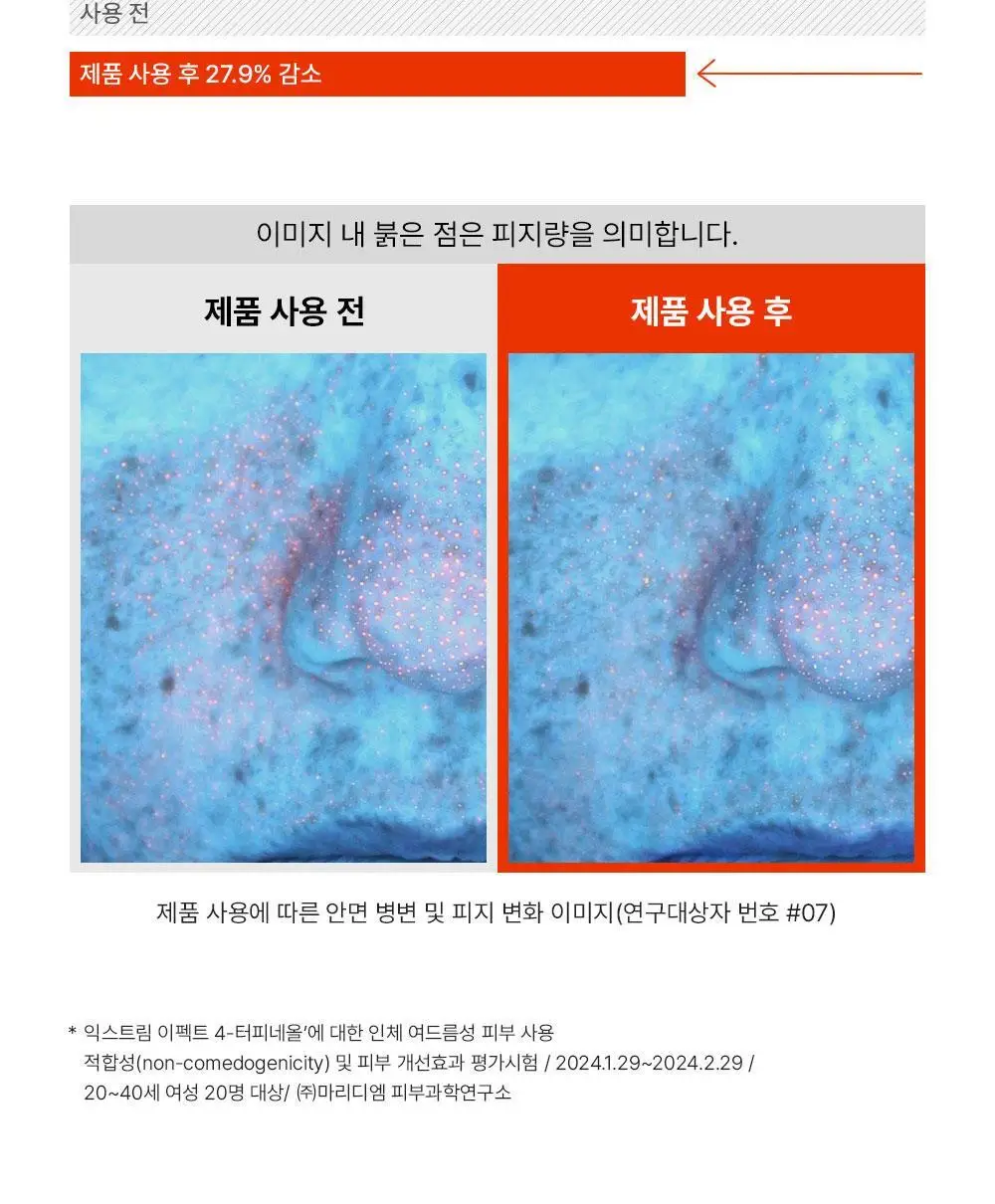 [트러블케어/스팟진정] 퍼셀 익스트림 이펙트 터피네올 원액 10ml 상세페이지 11